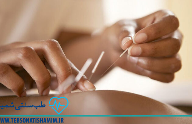 فیزیوتراپی و توانبخشی کرج | طب سوزنی در کرج