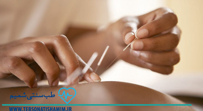 فیزیوتراپی و توانبخشی کرج | طب سوزنی در کرج
