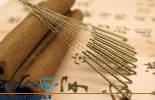 فیزیوتراپی و توانبخشی کرج | طب سوزنی در کرج