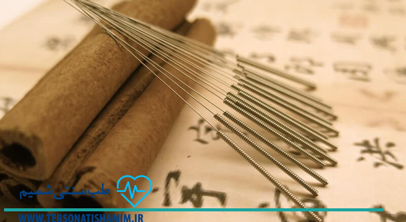 فیزیوتراپی و توانبخشی کرج | طب سوزنی در کرج
