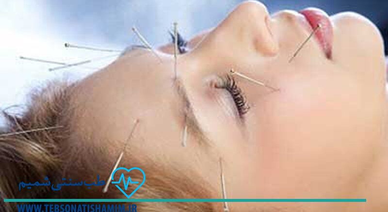 فیزیوتراپی و توانبخشی کرج | طب سوزنی در کرج