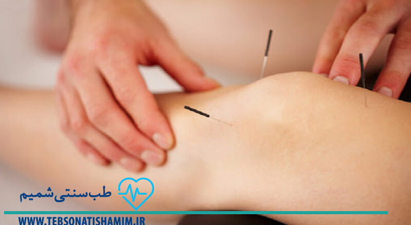 فیزیوتراپی و توانبخشی کرج | طب سوزنی در کرج