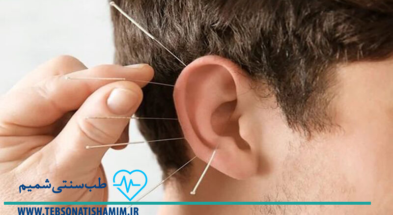 فیزیوتراپی و توانبخشی کرج | طب سوزنی در کرج