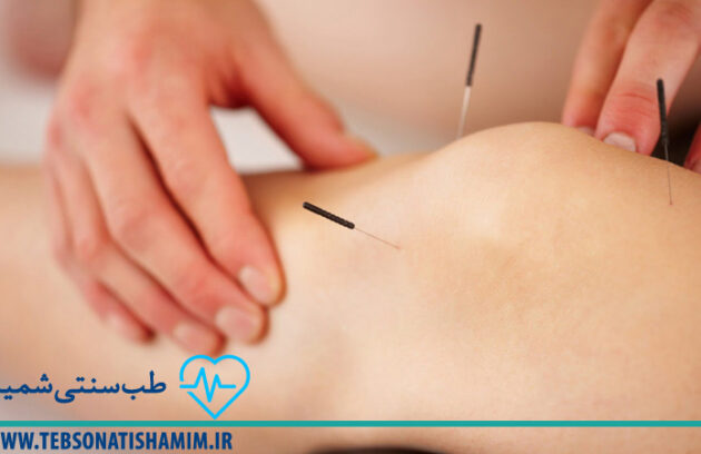 فیزیوتراپی و توانبخشی کرج | طب سوزنی در کرج
