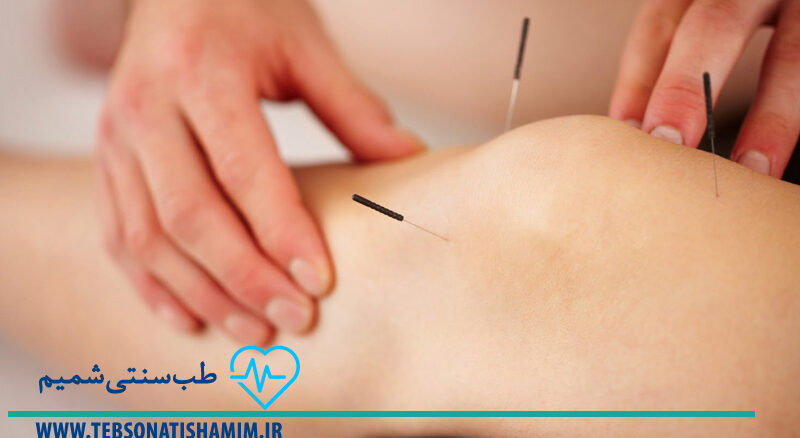 فیزیوتراپی و توانبخشی کرج | طب سوزنی در کرج