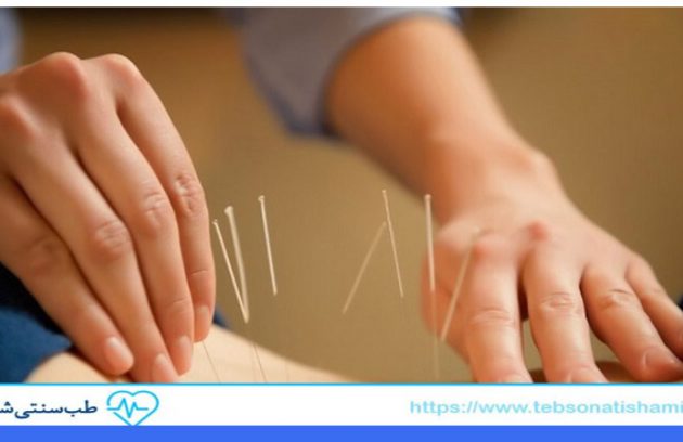  تأثیر طب سوزنی بر بهبود عملکرد سیستم ایمنی