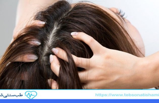 روش های سنتی کنترل چربی مو