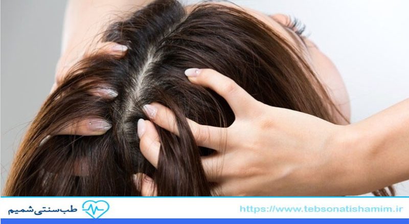 روش های سنتی کنترل چربی مو