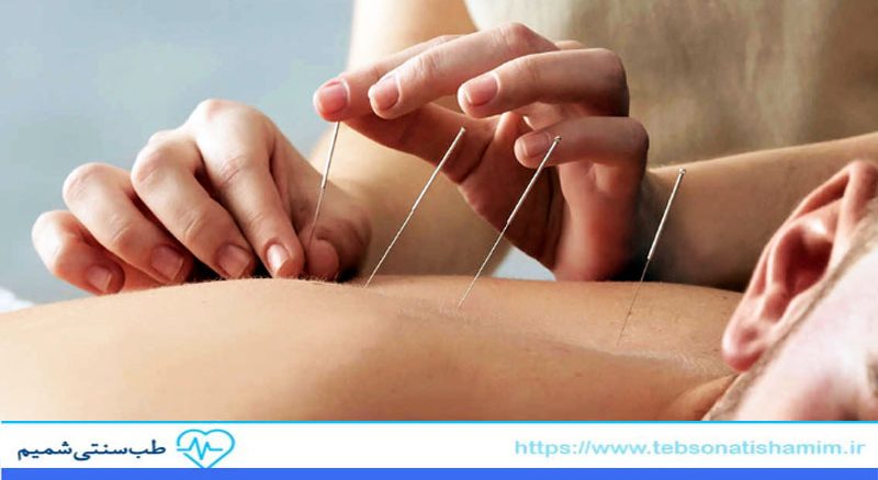 رازهای شفابخش طب سوزنی