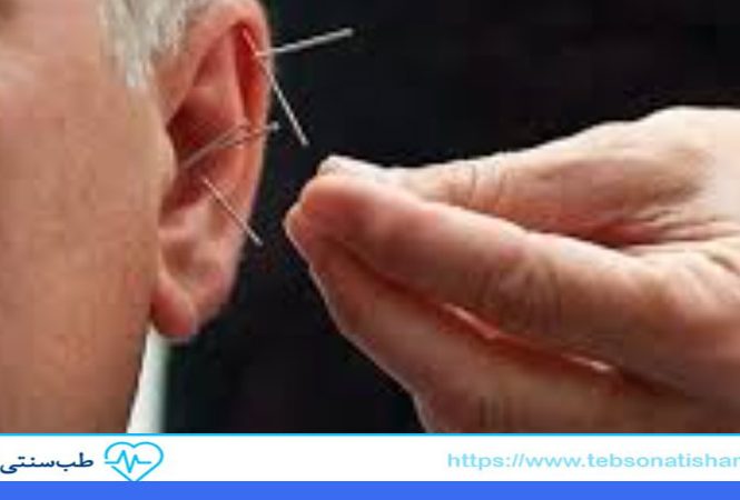 درمان مشکلات شنوایی با طب سوزنی