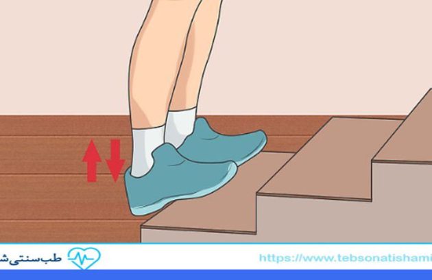 درمان کوتاهی تاندون آشیل در کودکان