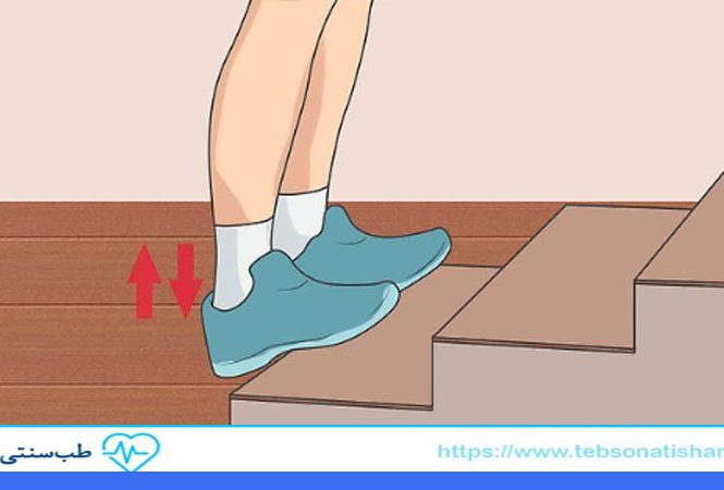 درمان کوتاهی تاندون آشیل در کودکان