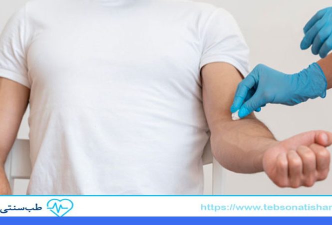 فصد خون چیست