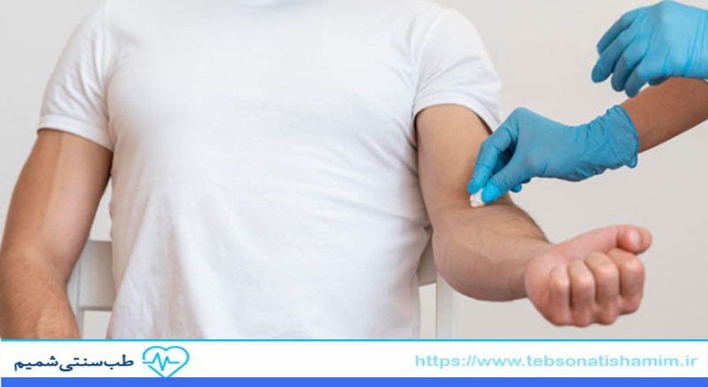 فصد خون چیست